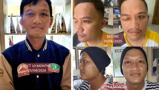 Dokumentasi pendukung artikel Pull Through